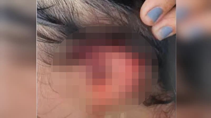 Agressor corta orelha de companheira durante briga no Careiro da Várzea