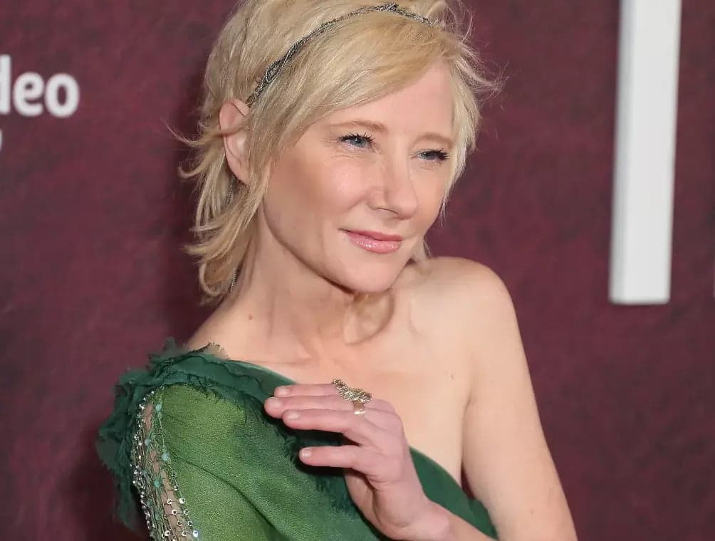 Atriz Anne Heche está em estado &#8220;extremamente crítico&#8221; após acidente de carro