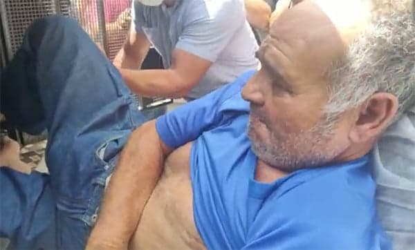 Suspeito de atear fogo em lotérica no Adolpho Lisboa recebe alta