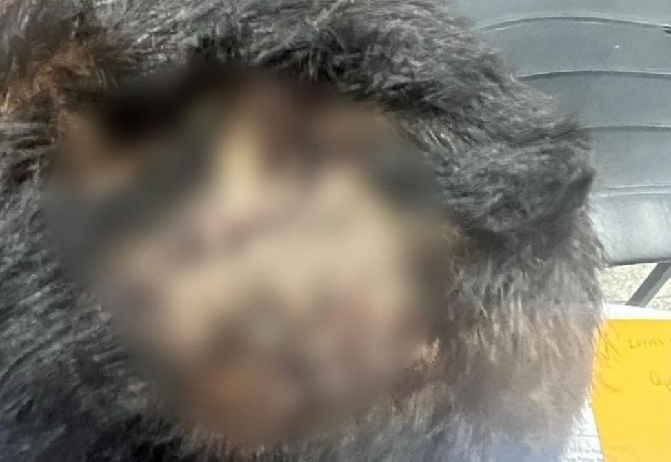 Criança de 6 anos tem cabeça quebrada por beber mingau da irmã em Manaus