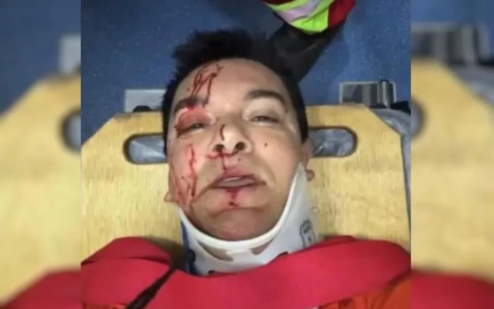 Regis Danese passa por cirurgia após acidente e está em estado grave na UTI