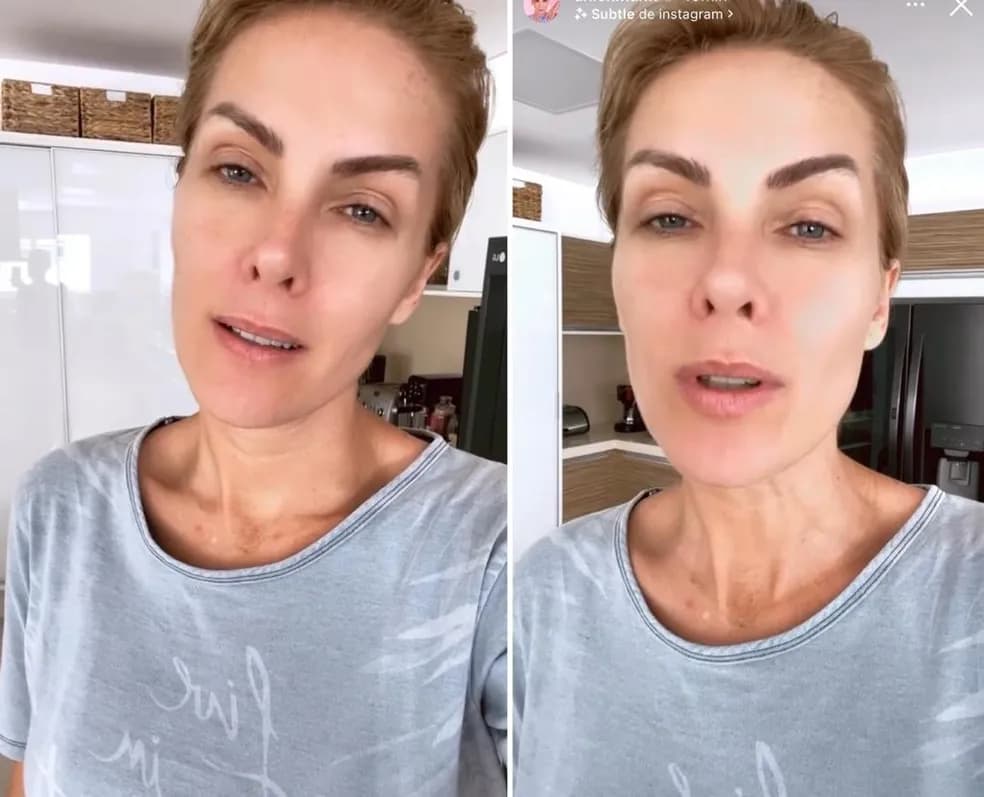VÍDEO: Ana Hickmann fala no Instagram sobre agressão que sofreu do marido