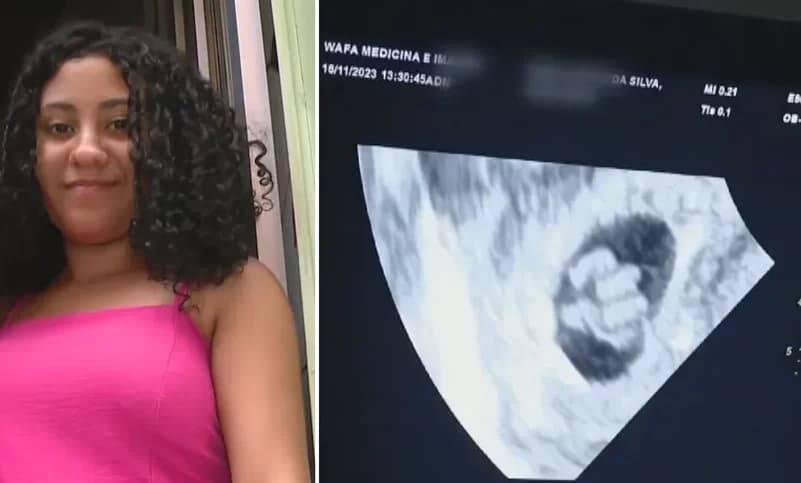 Após descobrir que está grávida de quíntuplos, jovem passa mal durante exame