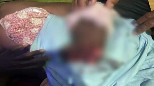 Homem é atacado por jacaré e tem braço lacerado, no AM
