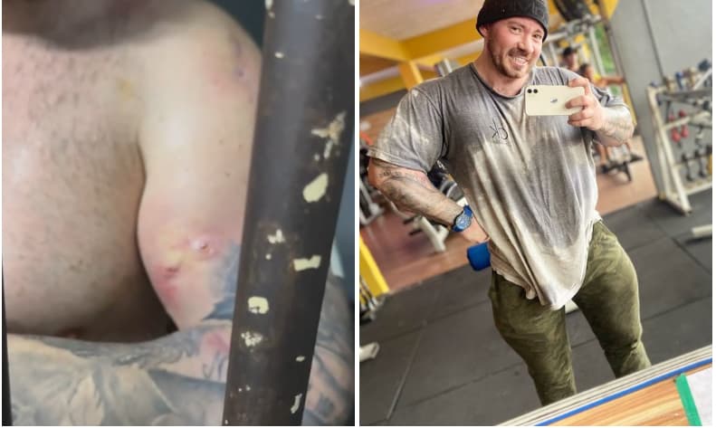 Caso Djidja: Em vídeo, Hatus Silveira revela marcas de feridas pelo corpo por uso excessivo de Potenay