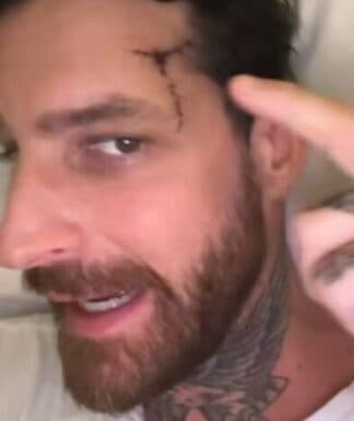 Marido da atriz Cleo Pires é internado na UTI após cair de skate