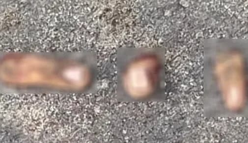 Dedos humanos são encontrados no meio da rua no bairro Alvorada