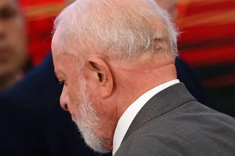 Lula retorna ao Planalto nesta segunda (6) após recuperação de cirurgia na cabeça
