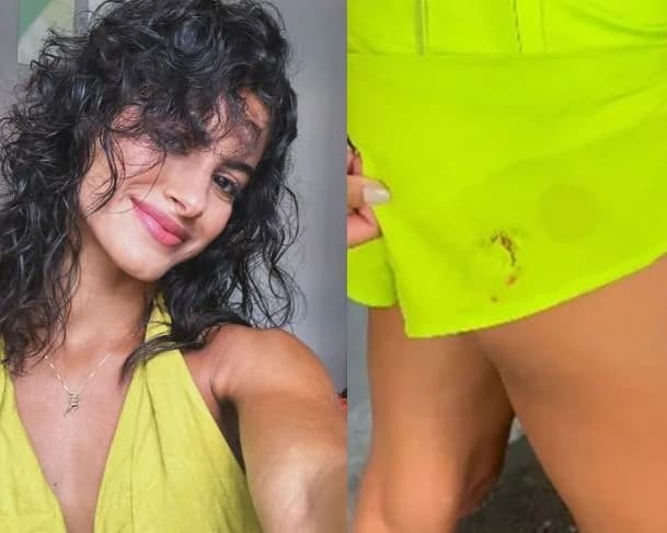 VÍDEO: Atriz de novela da Globo é atacada por cinco cães durante gravação em praia no RJ