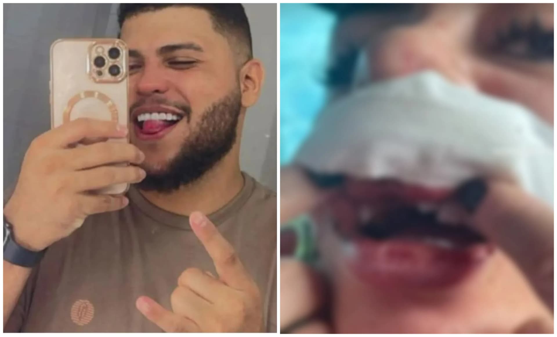 Mulher espancada por cantor ganha tratamento dentário em Manaus