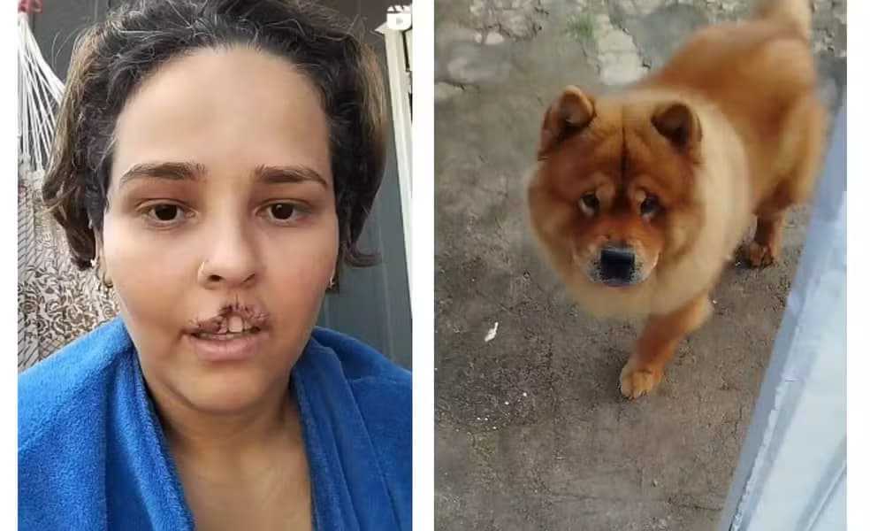 Cachorro arranca lábio de dona e marido manda matar animal sem avisar esposa