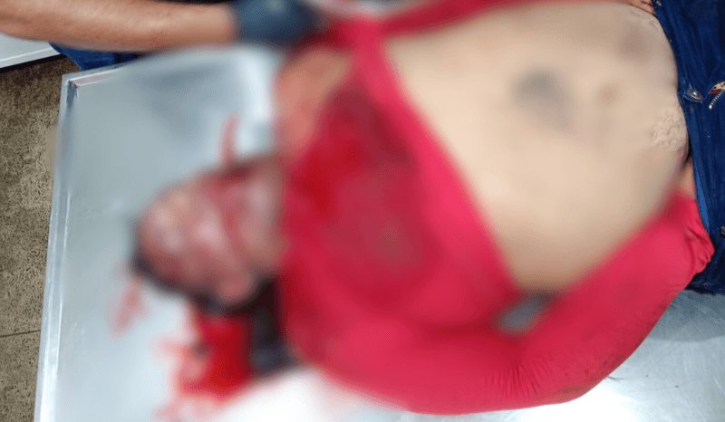 VÍDEO: Homem é morto a tiros em área isolada de Parintins; motocicleta foi abandonada no local