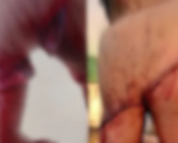 Homem acusado de agredir companheira é ferido a golpes de terçado pelo cunhado