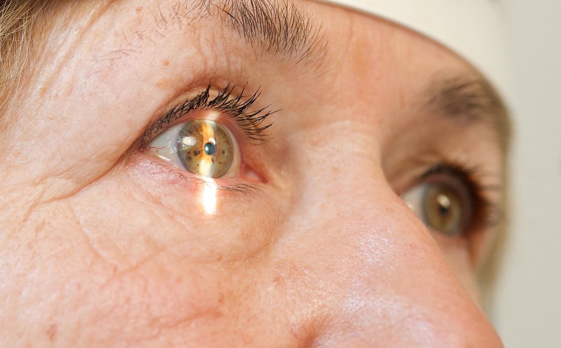 Campanha de Conscientização do Glaucoma avança na Câmara de Manaus