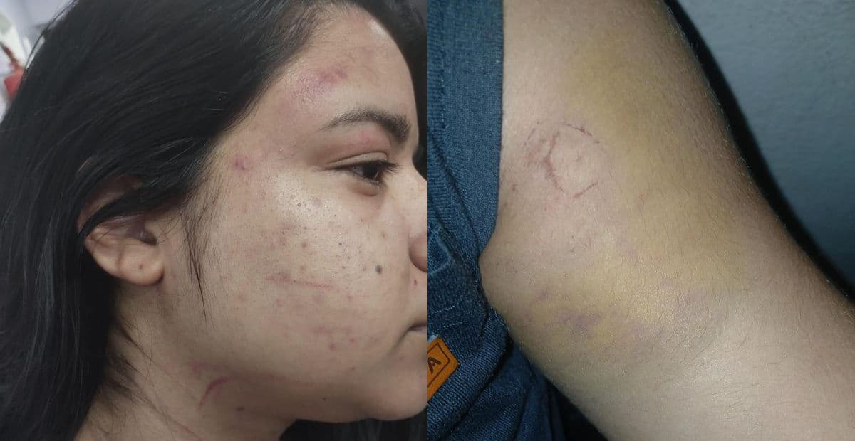 Jovem denuncia companheiro e familiares por agressão na frente da filha de 7 anos em Manaus