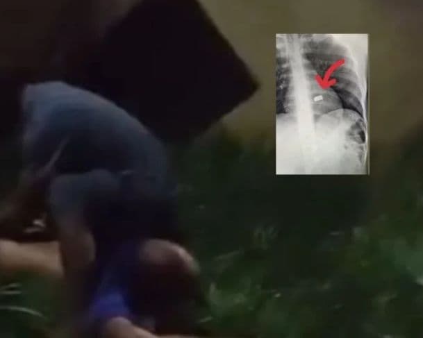 Imagens Fortes: ‘Livrinho’ é baleado por criminosos e agoniza até morte no Amazonas