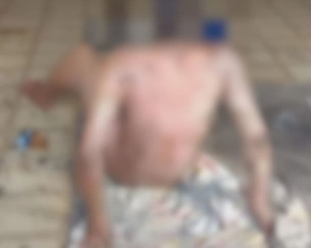 VÍDEO: &#8220;Passarinho&#8221; é preso após incendiar colega de quarto em Tefé; vítima está em estado grave