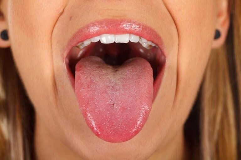 Pesquisadores desenvolvem biossensor para detectar depressão e esquizofrenia pela saliva