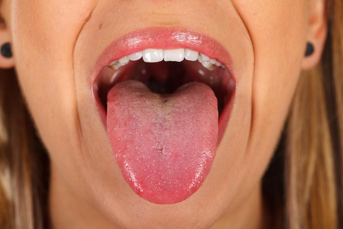Pesquisadores desenvolvem biossensor para detectar depressão e esquizofrenia pela saliva