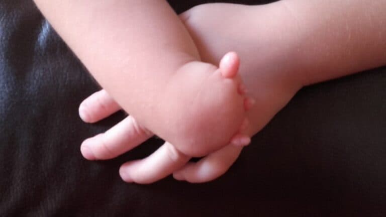 Projeto sugere 30 de setembro como dia de apoio e inclusão a pessoas com agenesia