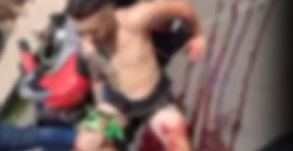 Motociclista fica gravemente ferido em acidente no conjunto Ajuricaba; vídeo