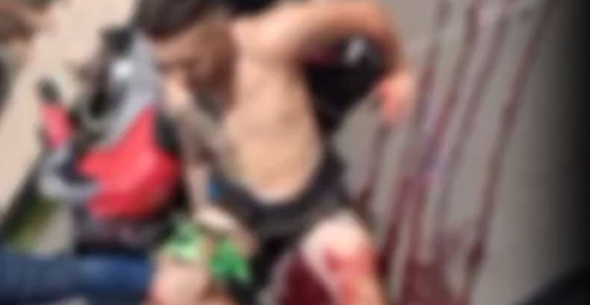 Motociclista fica gravemente ferido em acidente no conjunto Ajuricaba; vídeo