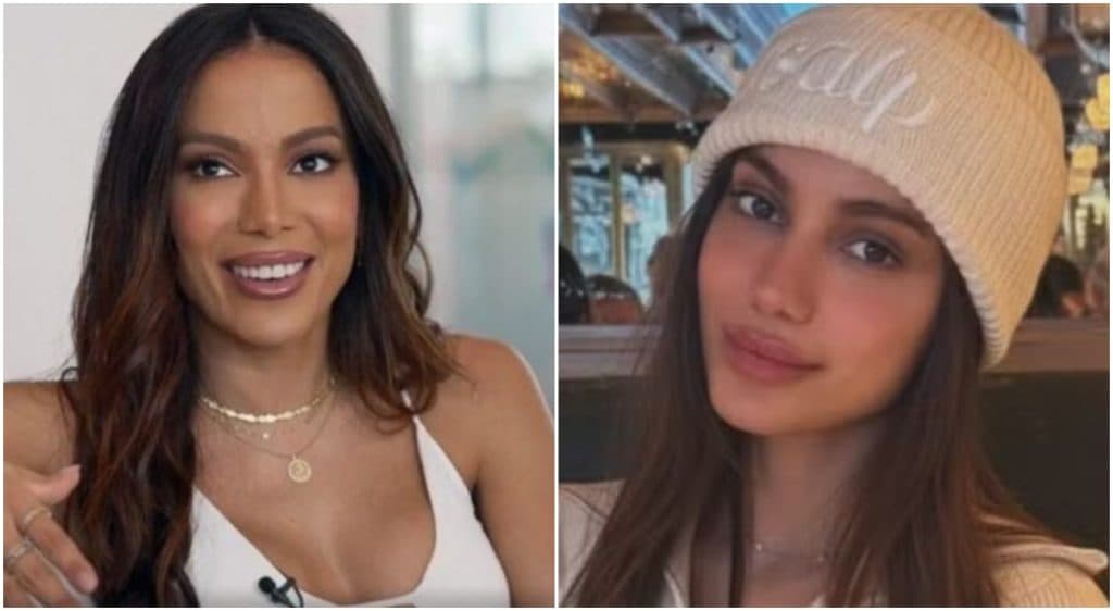 Anitta chama atenção ao aparecer com rosto diferente nas redes