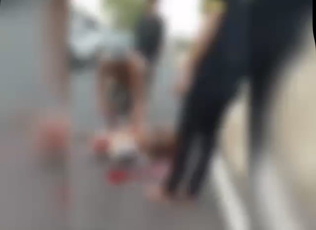 Idoso tem pé decepado em atropelamento na BR-316 e morre em Teresina