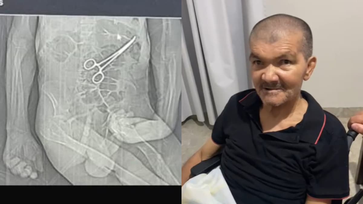 Idoso morre no Natal após ter pinça esquecida dentro do corpo, em MG