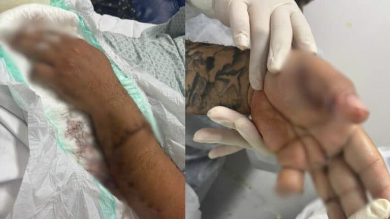 Motorista de app tem dedo decepado a terçadadas ao cobrar pagamento de passageiro em Manaus