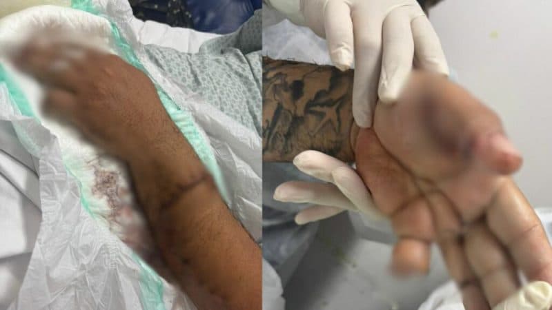 Motorista de app tem dedo decepado a terçadadas ao cobrar pagamento de passageiro em Manaus