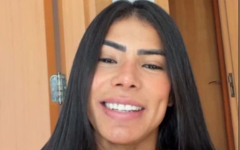 Marciele Albuquerque controla queda de cabelo por alopecia emocional