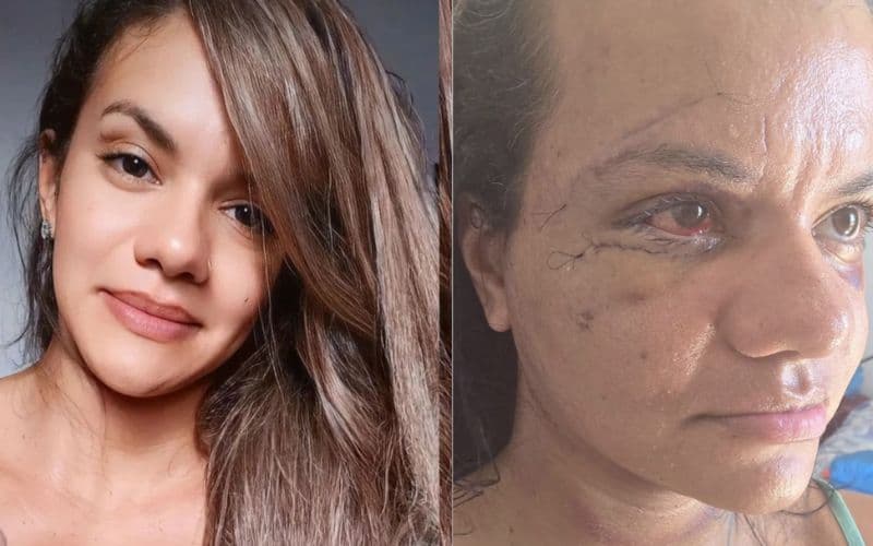 Quem mutilar rosto e genitália de uma mulher pode passar mais tempo na cadeia