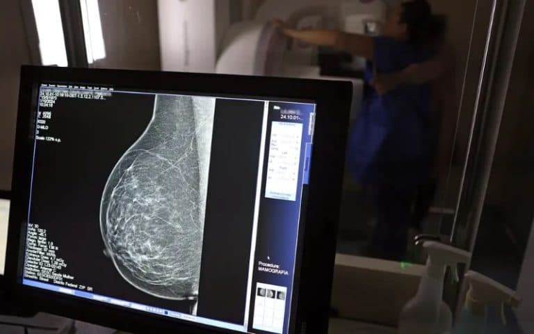 SUS pode incluir medicamento para câncer de mama com risco de recorrência