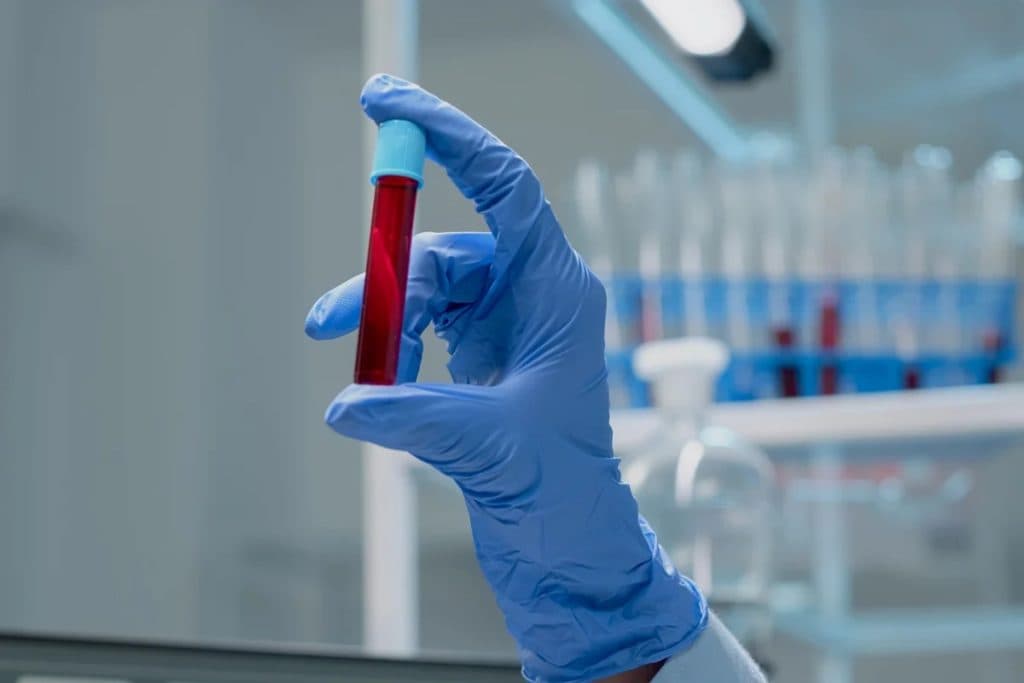 Novo exame de sangue para câncer chega ao Brasil