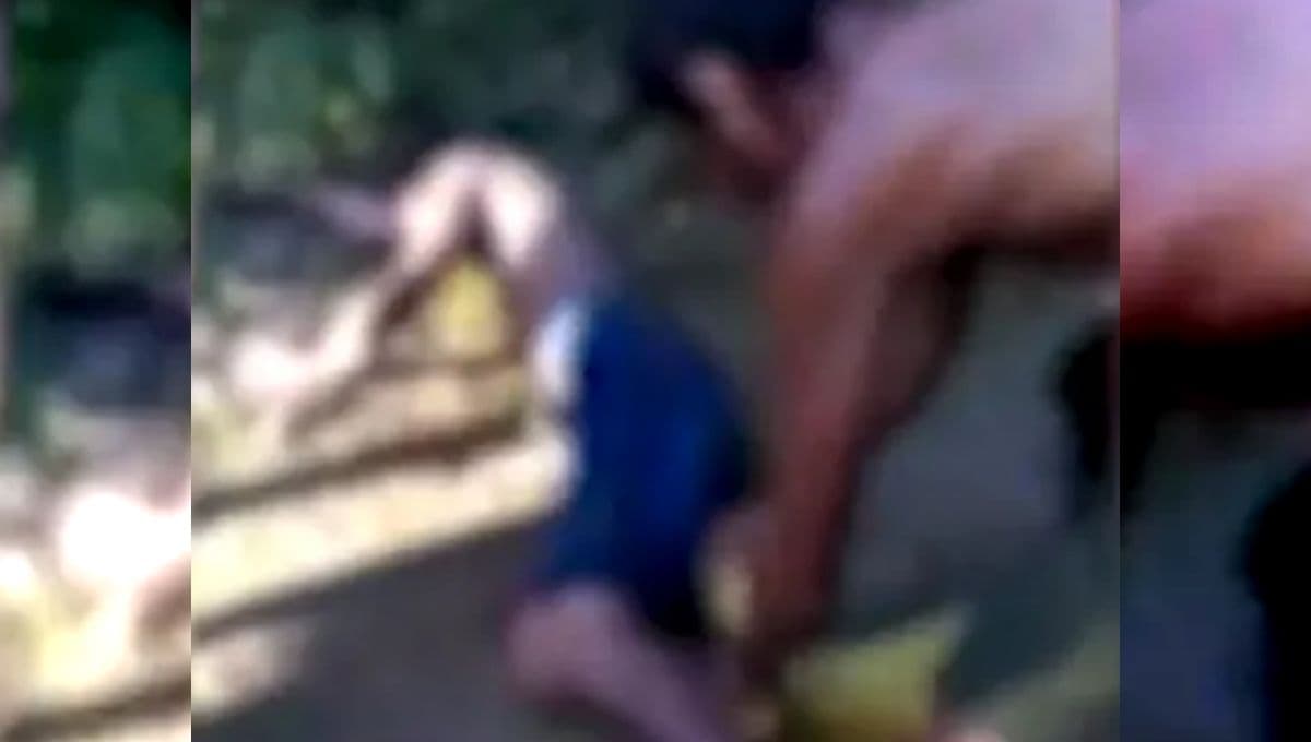Em vídeo, pai de jovem com pé decepado em Manacapuru desabafa: ‘Eu te avisei, mas o cara não ouve’