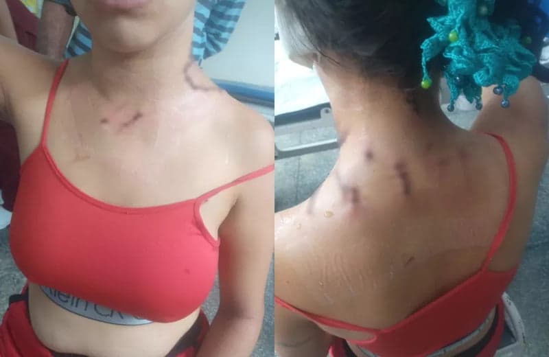 Em Coari, mulher tenta impedir briga e leva facadas do próprio marido