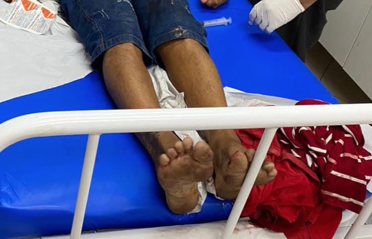 Jovem é baleado na cabeça enquanto almoçava em bar