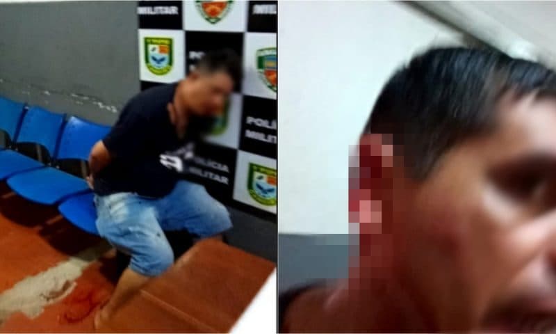 Policial tem parte da orelha arrancada dentro de quartel no Amazonas