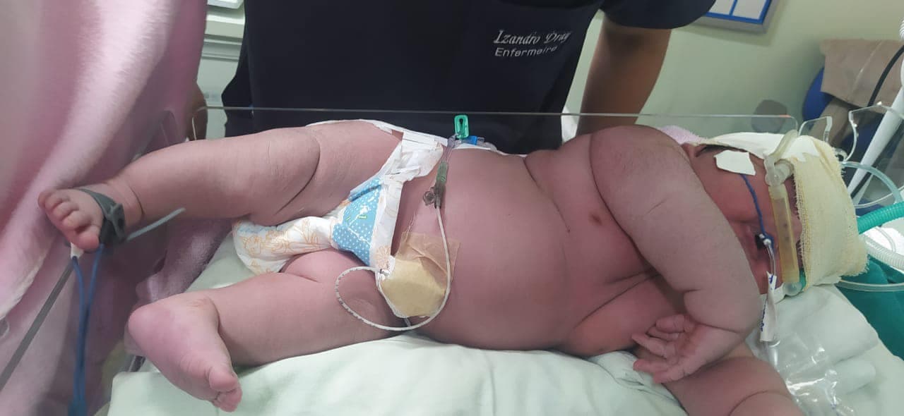 “Bebê gigante” de Parintins bate recorde e é o maior nascido no AM
