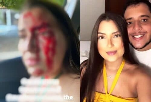 IMAGEM FORTE: Filho de delegado é preso suspeito de agredir namorada