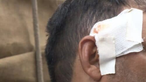 Homem é esfaqueado e tem pedaço de vidro cravado na cabeça, em Manaus