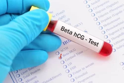 Farmácias começam a fazer exames de análises clínicas; Saiba quais
