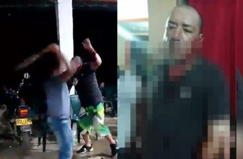 VÍDEO: Homens brigam em mesa de bar, e um deles acaba com braço parcialmente decepado, na Colômbia