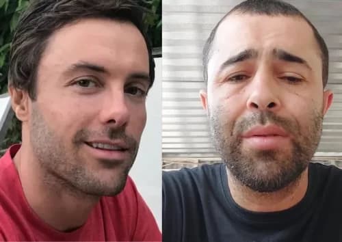 VÍDEO: Vaquinha para motorista que atropelou Kayky Brito arrecada mais de R$ 120 mil
