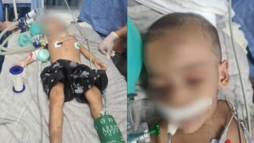 VÍDEO: Criança de 2 anos é internada em estado gravíssimo em Manaus após ser torturada pelo marido da tia