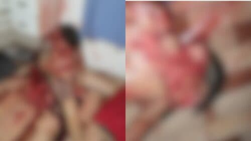 ‘Loirinho’ é executado com mais de 30 tiros de fuzil e tem rosto desfigurado, no AM