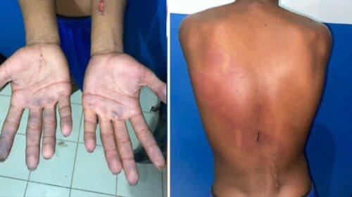 Adolescente é salvo do “tribunal do crime” após ter sido “condenado” por roubo de botijão, no Pará