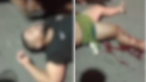 VÍDEO: Homem fica jogado ao chão com a perna supostamente quebrada após acidente, em Manaus