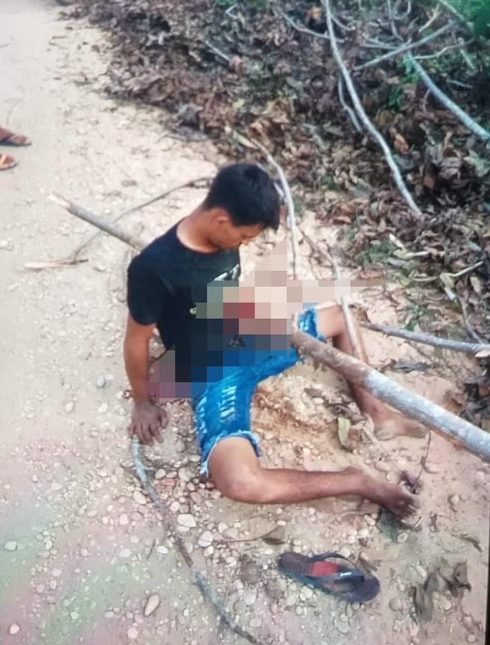 Jovem fica com tronco atravessado no peito após acidente de moto, no norte do Tocantins